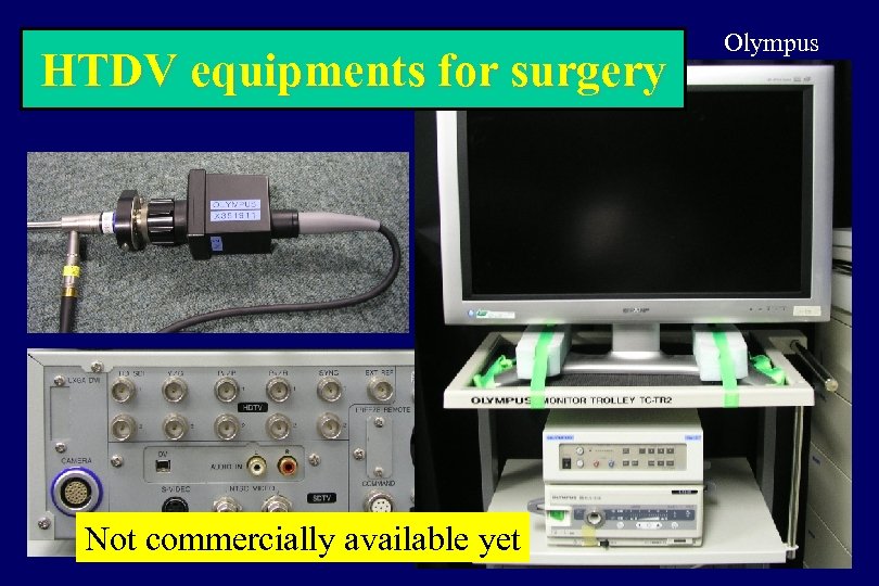 HTDV equipments for surgery Not commercially available yet Olympus 