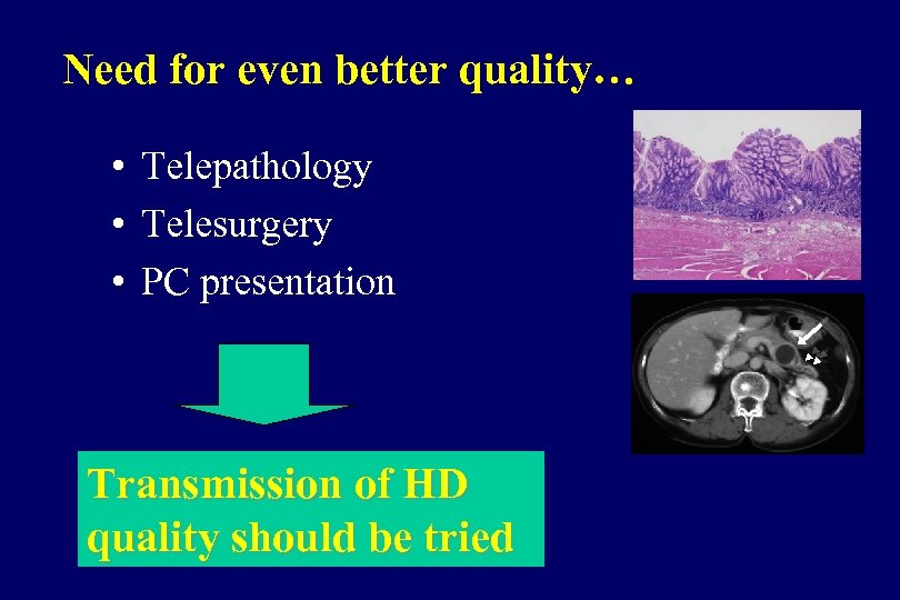 Need for even better quality… • Telepathology • Telesurgery • PC presentation Transmission of