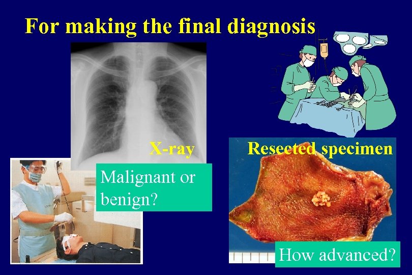 For making the final diagnosis X-ray Resected specimen Malignant or benign? How advanced? 