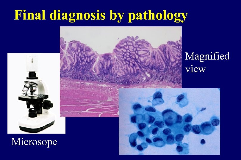 Final diagnosis by pathology Magnified view Microsope 