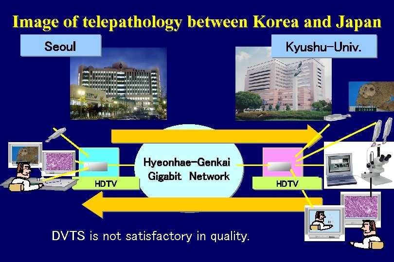 Image of telepathology between Korea and Japan Seoul Kyushu-Univ. ＤＶＴＳ HDTV Hyeonhae-Genkai Gigabit　Network DVTS
