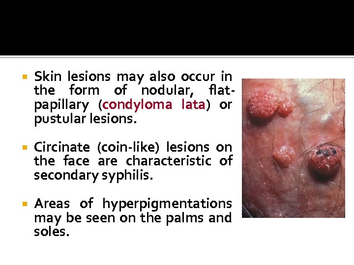  Skin lesions may also occur in the form of nodular, flatpapillary (condyloma lata)