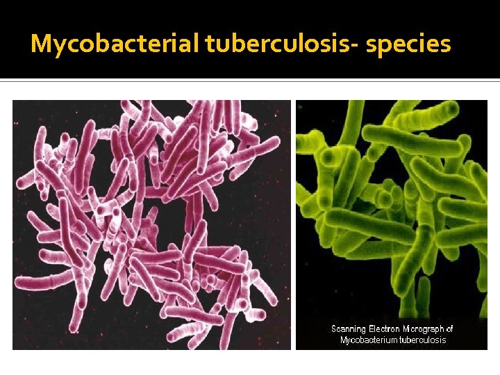 Mycobacterial tuberculosis- species 