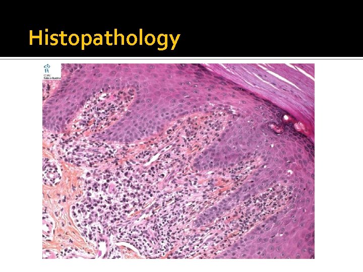 Histopathology 