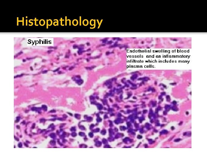 Histopathology 