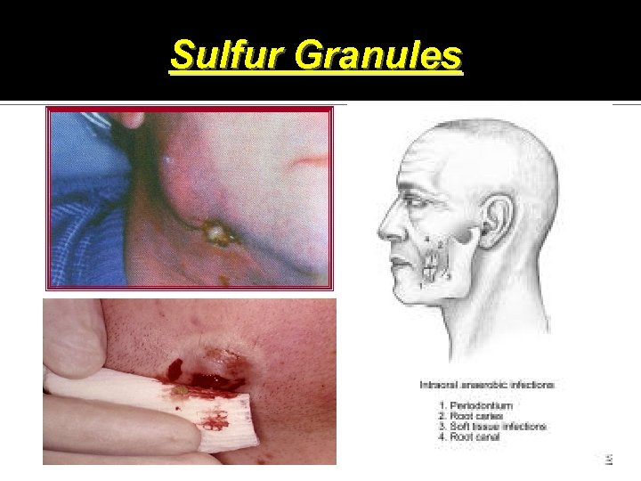 Sulfur Granules 