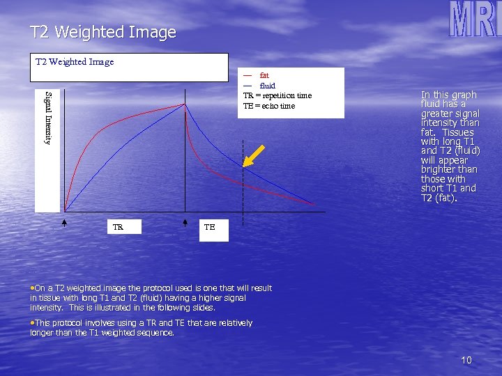 T 2 Weighted Image—long TR and TE Signal Intensity — fat — fluid TR