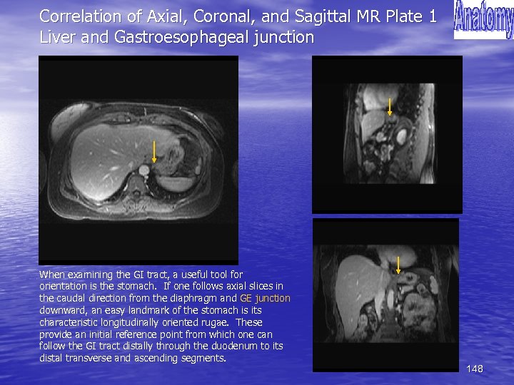 Correlation of Axial, Coronal, and Sagittal MR Plate 1 Liver and Gastroesophageal junction When