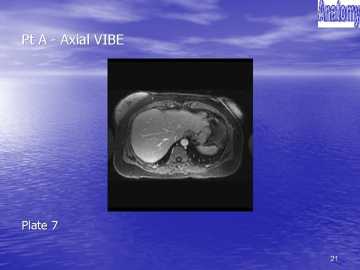 Pt A - Axial VIBE Plate 7 21 