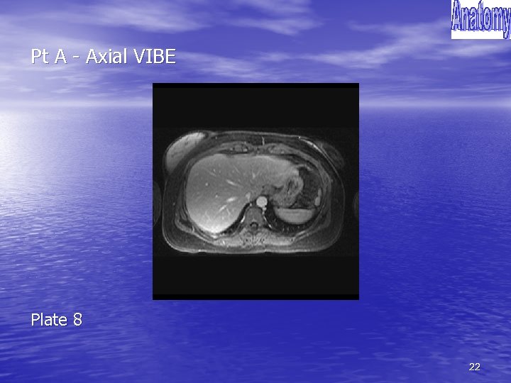 Pt A - Axial VIBE Plate 8 22 