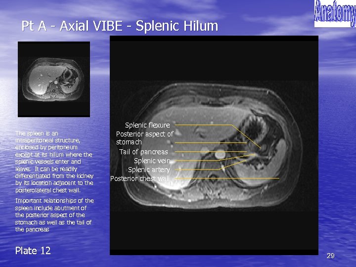 Pt A - Axial VIBE - Splenic Hilum The spleen is an intraperitoneal structure,