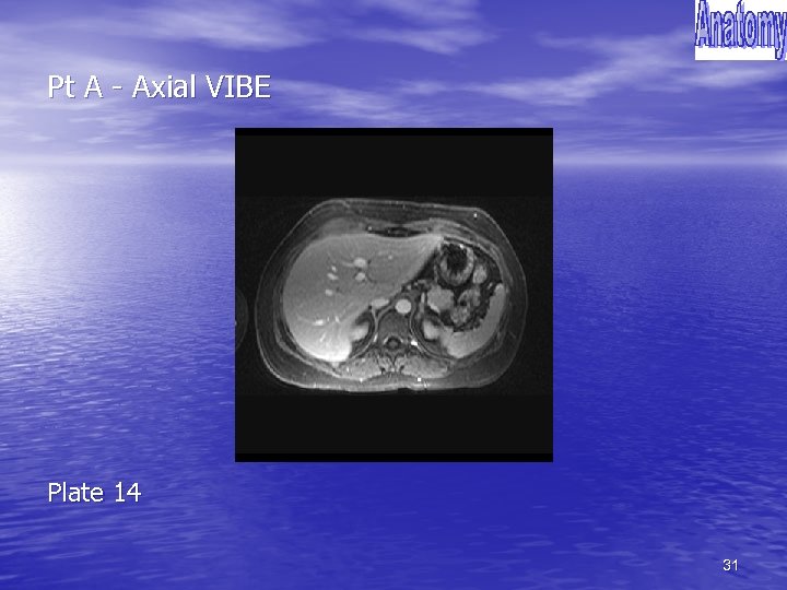 Pt A - Axial VIBE Plate 14 31 