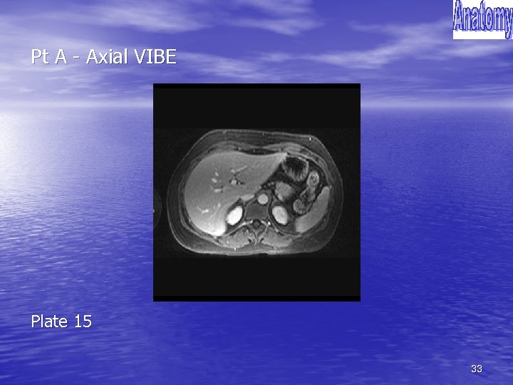 Pt A - Axial VIBE Plate 15 33 