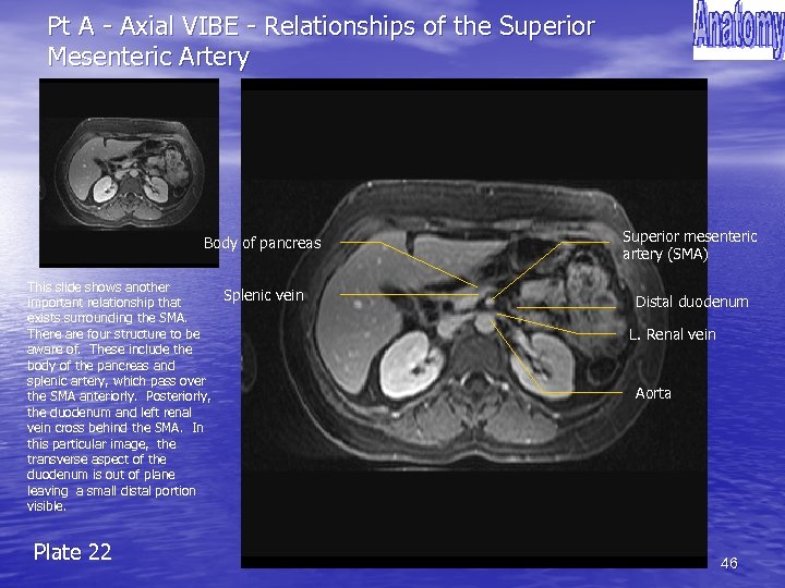 Pt A - Axial VIBE - Relationships of the Superior Mesenteric Artery Body of