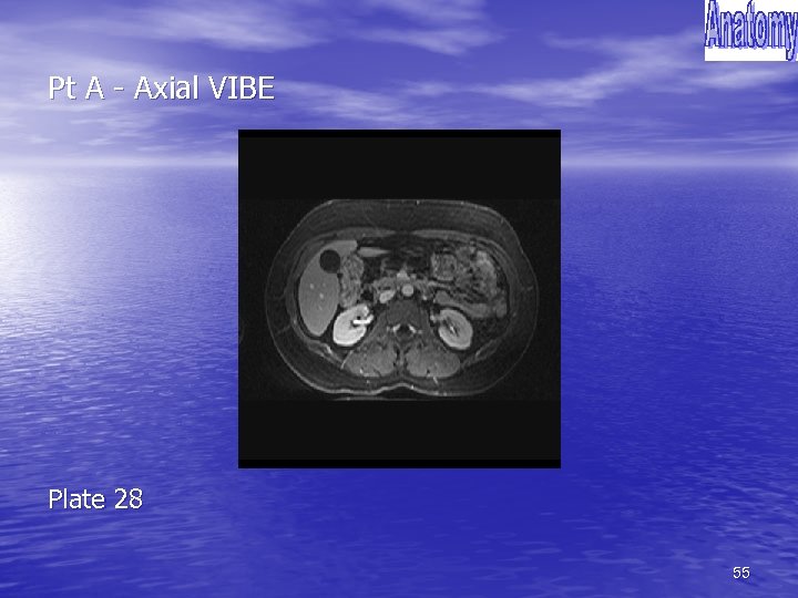 Pt A - Axial VIBE Plate 28 55 