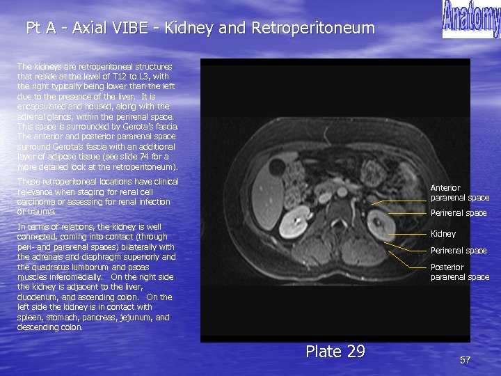Pt A - Axial VIBE - Kidney and Retroperitoneum The kidneys are retroperitoneal structures
