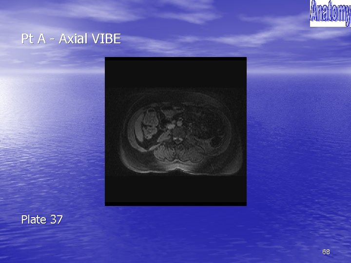 Pt A - Axial VIBE Plate 37 68 