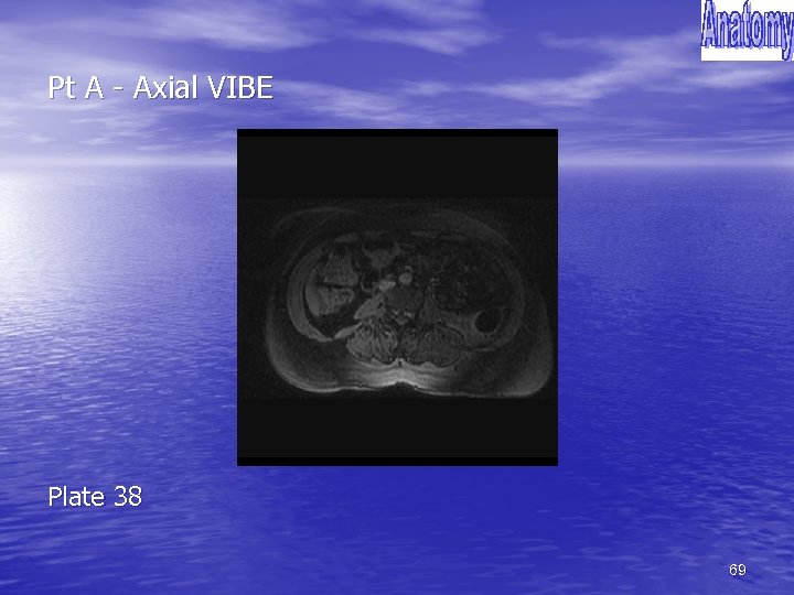 Pt A - Axial VIBE Plate 38 69 