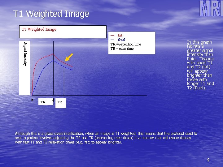 T 1 Weighted Image—short TR and TE Signal Intensity — fat — fluid TR