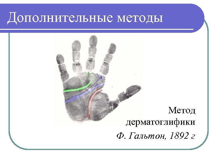 Дополнительные методы Метод дерматоглифики Ф. Гальтон, 1892 г 