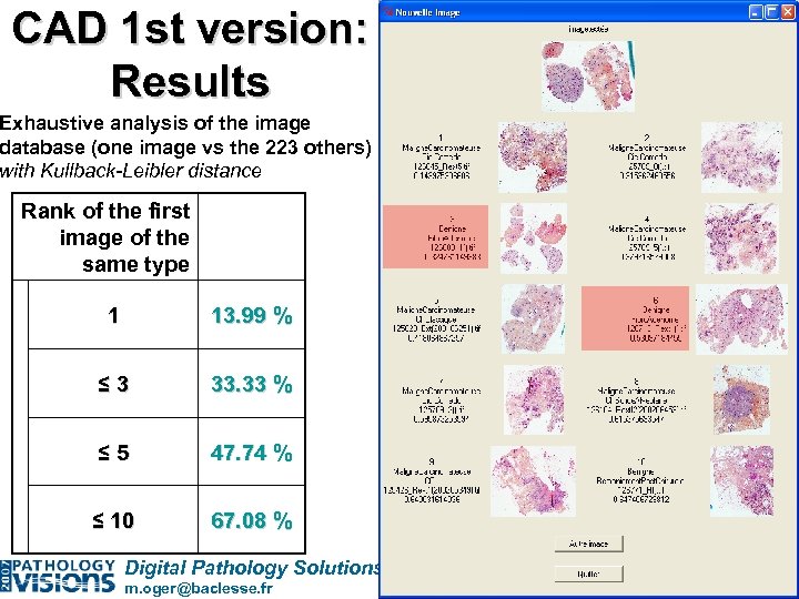 CAD 1 st version: Results Exhaustive analysis of the image database (one image vs
