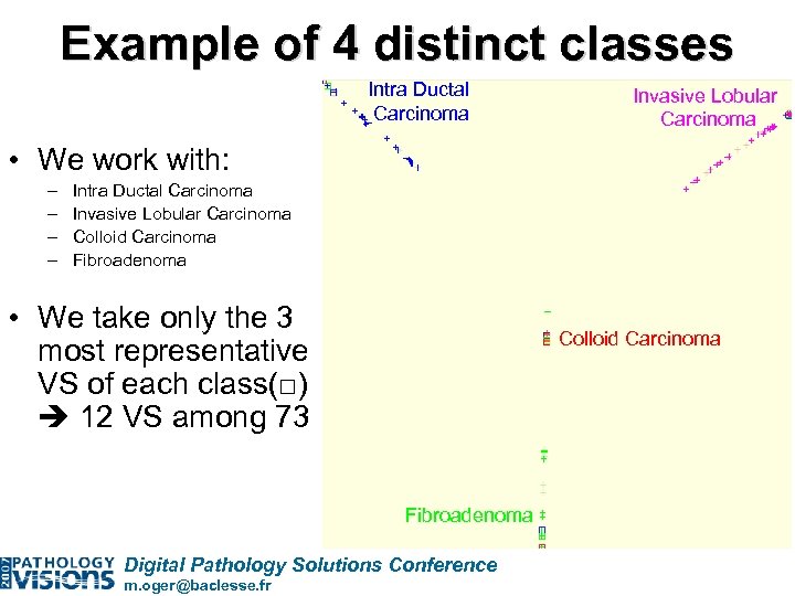 Example of 4 distinct classes Intra Ductal Carcinoma Invasive Lobular Carcinoma • We work