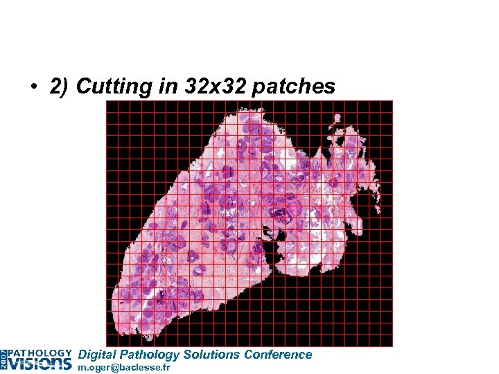  • 2) Cutting in 32 x 32 patches Digital Pathology Solutions Conference m.