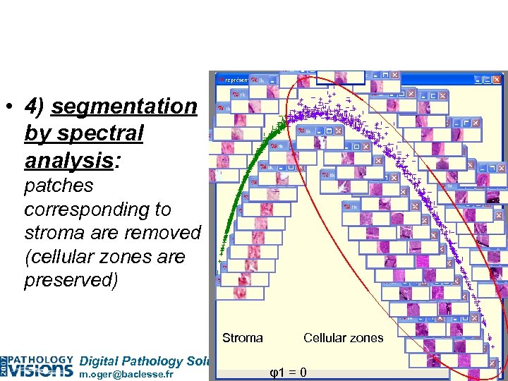  • 4) segmentation by spectral analysis: patches corresponding to stroma are removed (cellular