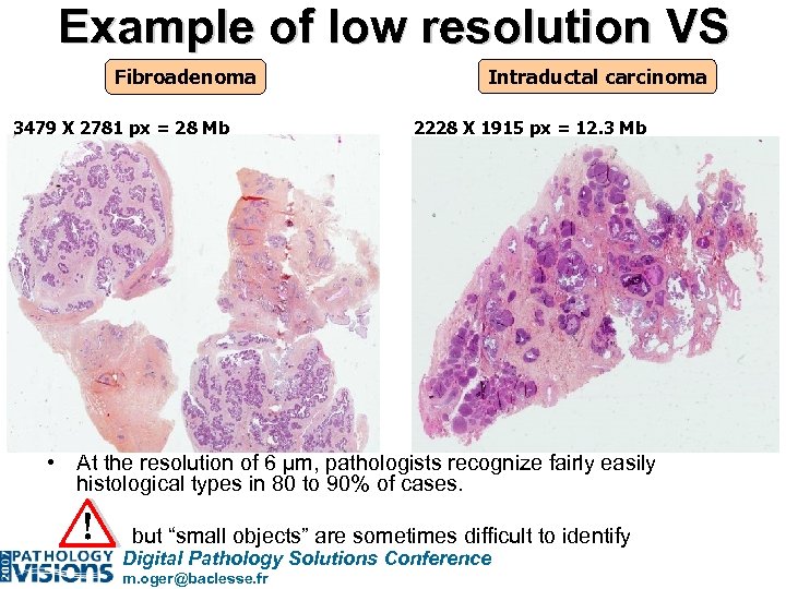 Example of low resolution VS Fibroadenoma 3479 X 2781 px = 28 Mb Intraductal