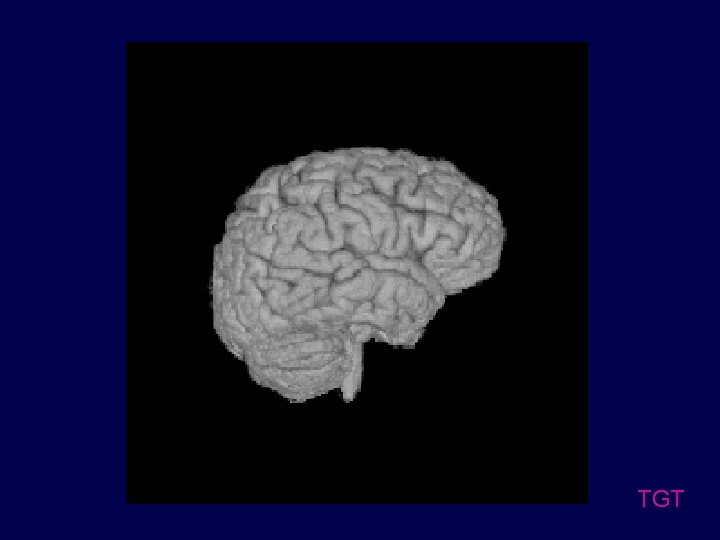 TGT 