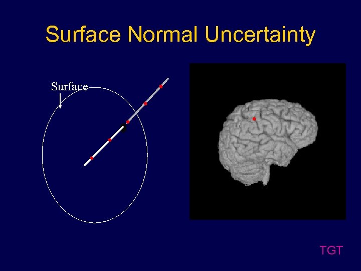 Surface Normal Uncertainty Surface TGT 
