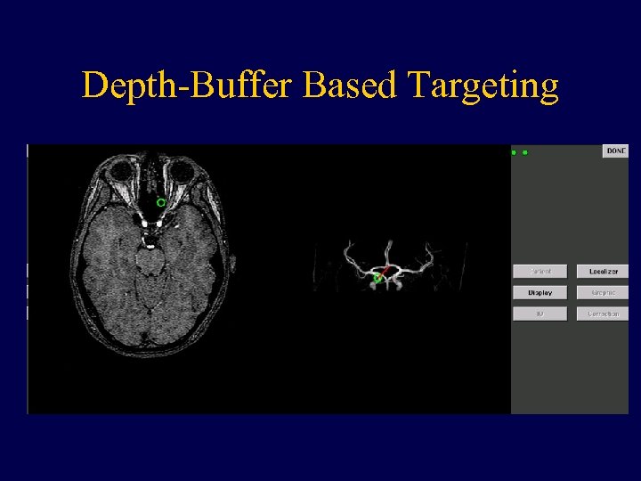 Depth-Buffer Based Targeting 