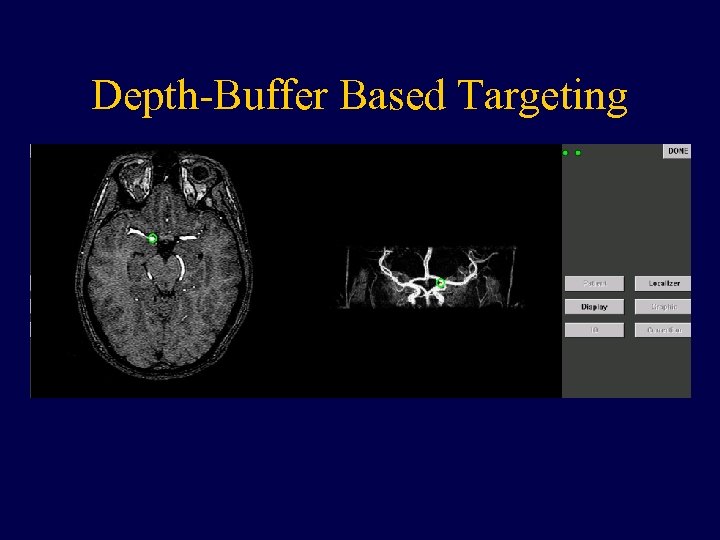 Depth-Buffer Based Targeting 