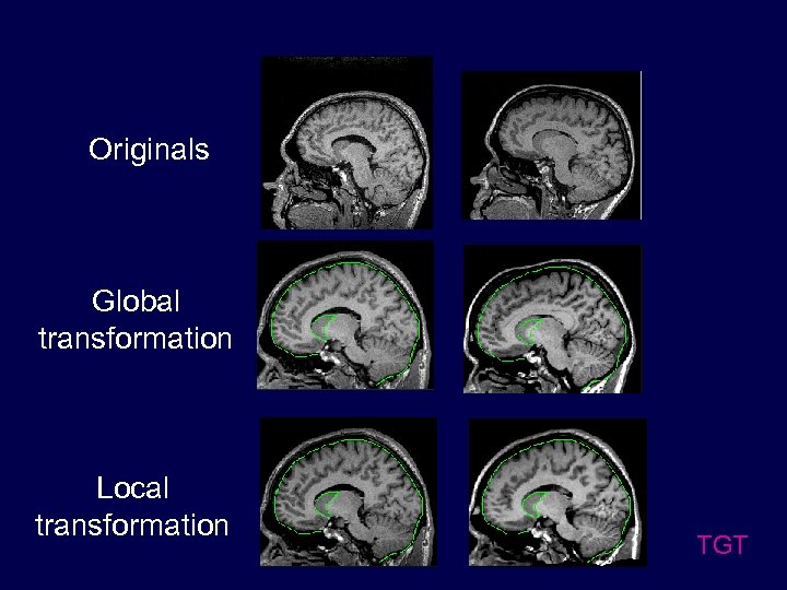 Originals Global transformation Local transformation TGT 