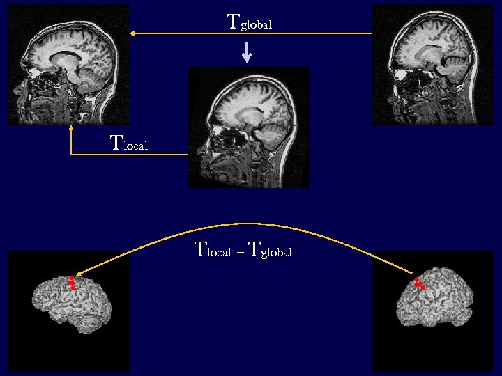 Tglobal Tlocal + Tglobal 