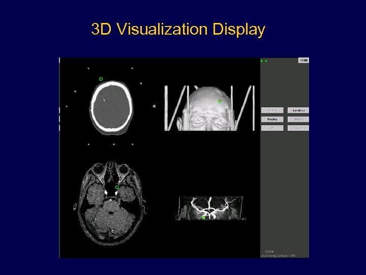 3 D Visualization Display 
