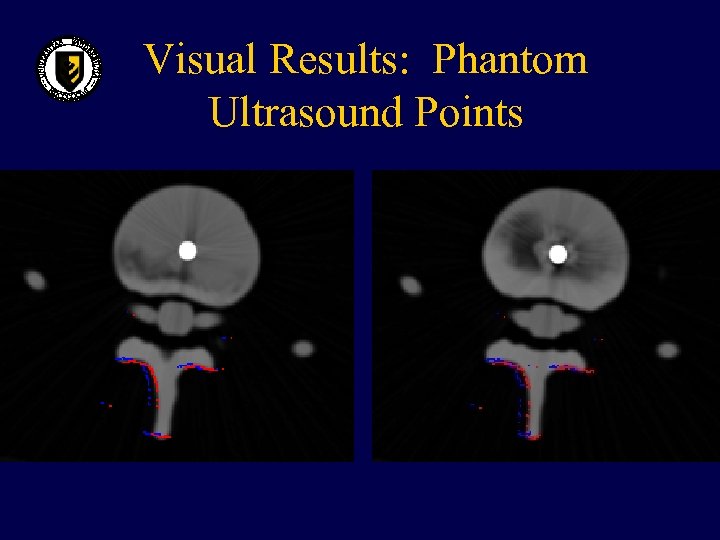 Visual Results: Phantom Ultrasound Points 