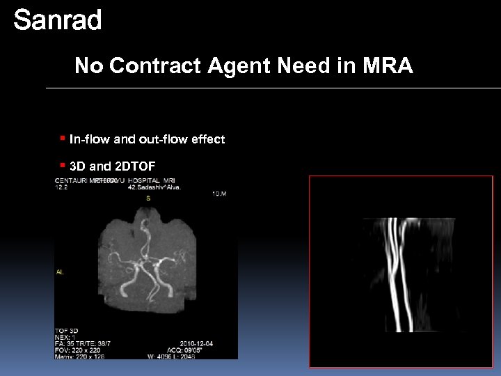 Sanrad No Contract Agent Need in MRA § In-flow and out-flow effect § 3