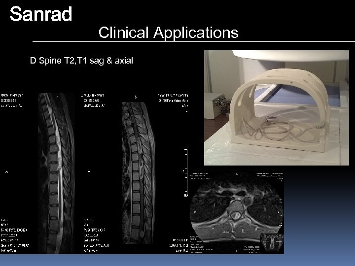 Sanrad Clinical Applications D Spine T 2, T 1 sag & axial 