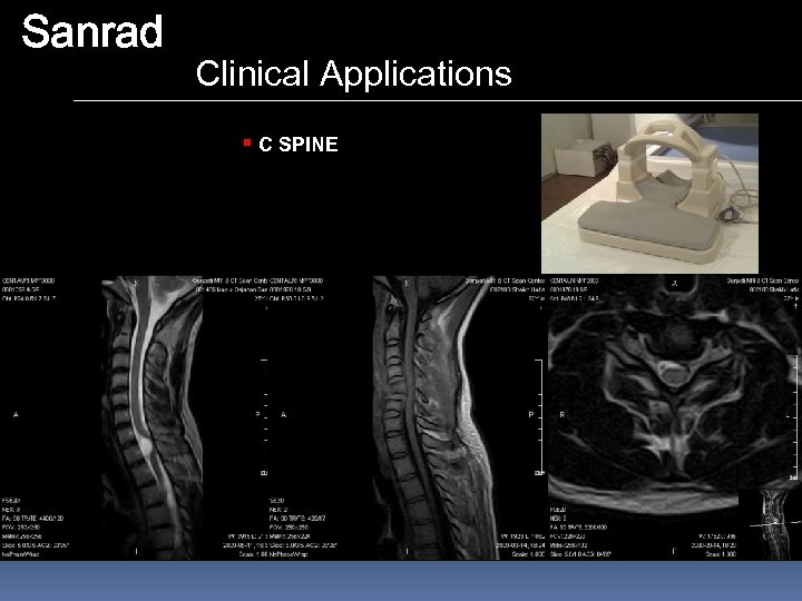 Sanrad Clinical Applications § C SPINE 