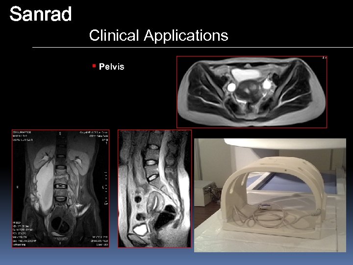 Sanrad Clinical Applications § Pelvis 