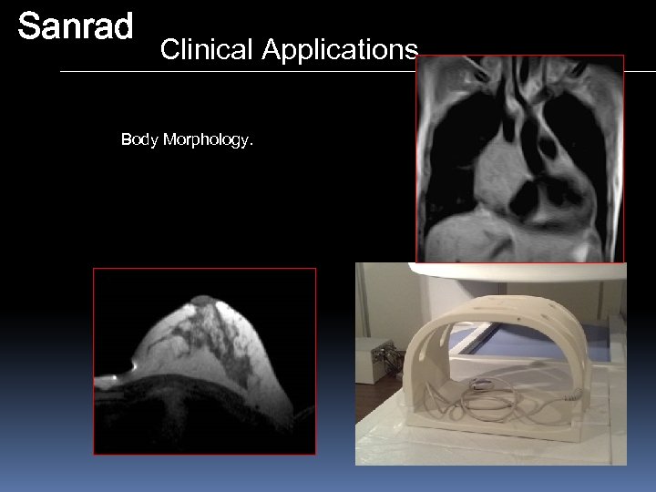 Sanrad Clinical Applications Body Morphology. 