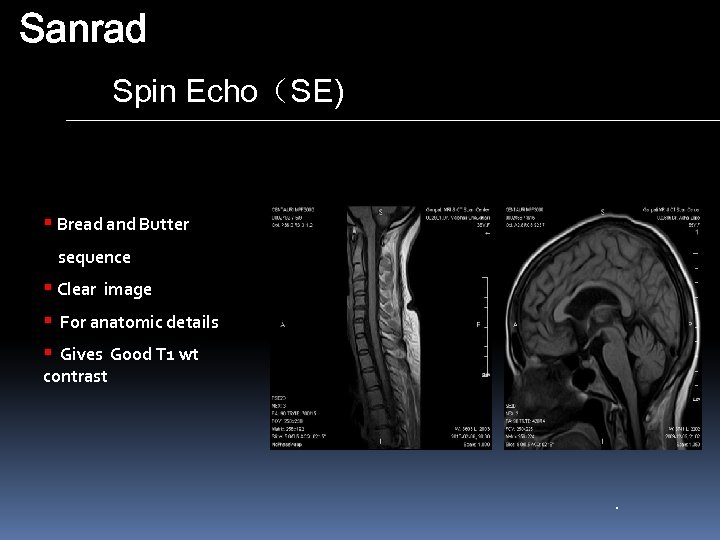 Sanrad Spin Echo（SE) § Bread and Butter sequence § Clear image § For anatomic