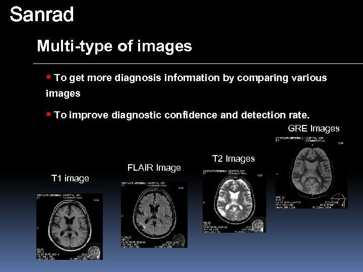 Sanrad Multi-type of images § To get more diagnosis information by comparing various images
