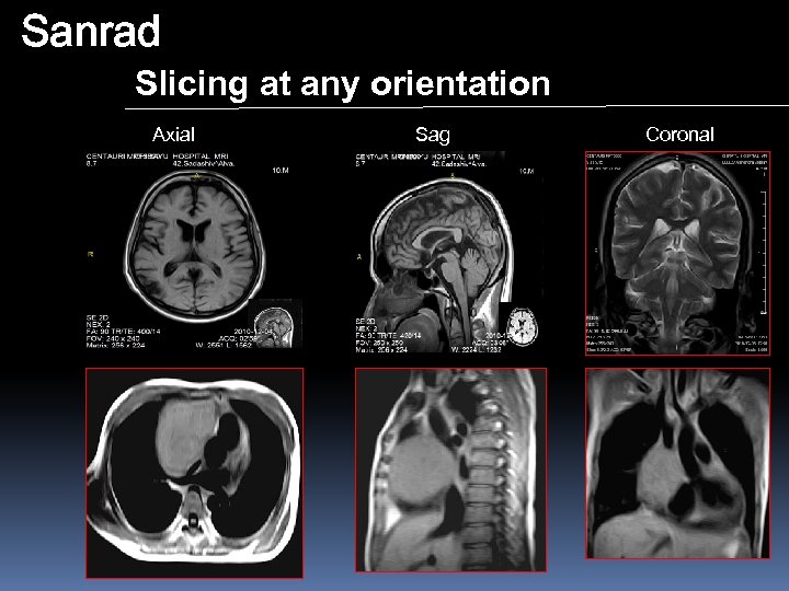 Sanrad Slicing at any orientation Axial Sag Coronal 