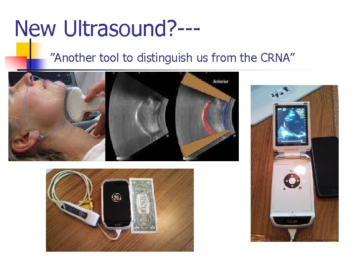 New Ultrasound? --”Another tool to distinguish us from the CRNA” 