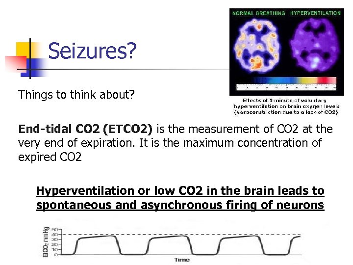 Seizures? Things to think about? End-tidal CO 2 (ETCO 2) is the measurement of