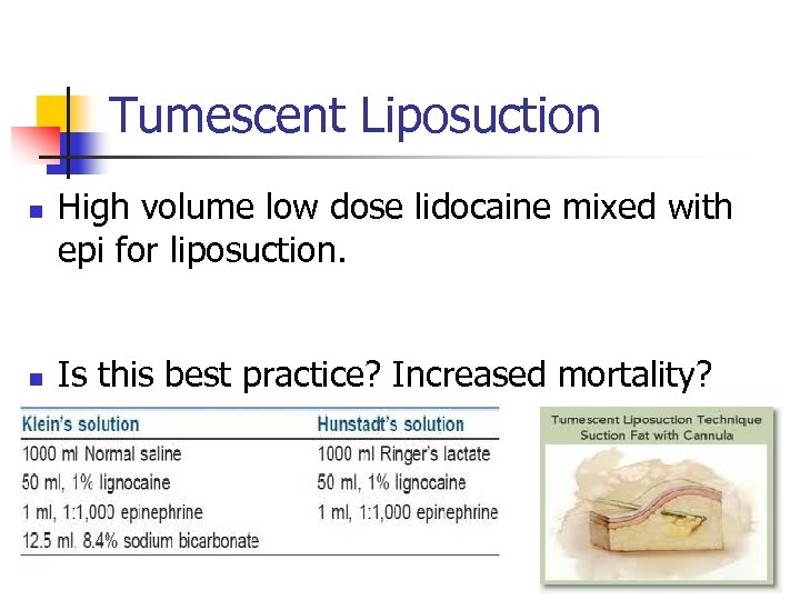 Tumescent Liposuction n n High volume low dose lidocaine mixed with epi for liposuction.