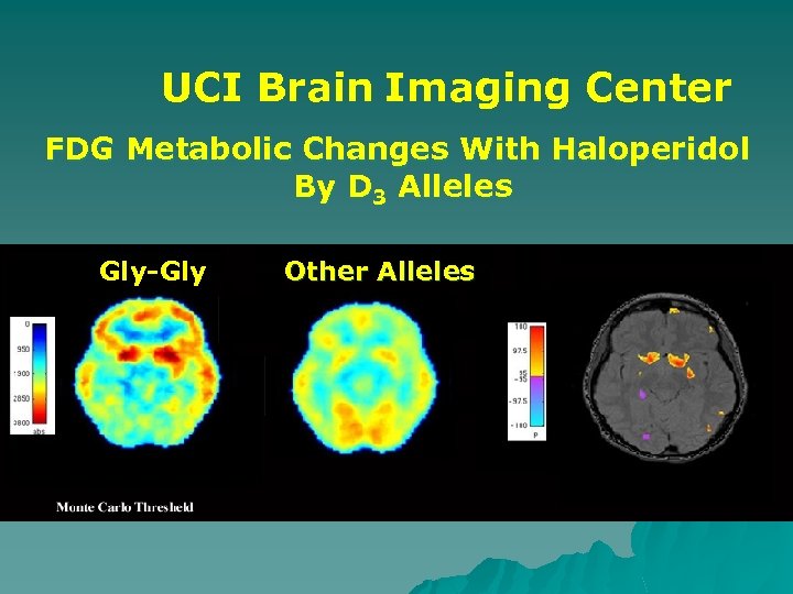 UCI Brain Imaging Center FDG Metabolic Changes With Haloperidol By D 3 Alleles Gly-Gly