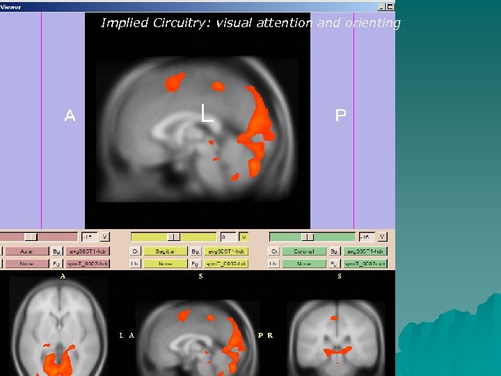 Implied Circuitry: visual attention and orienting 